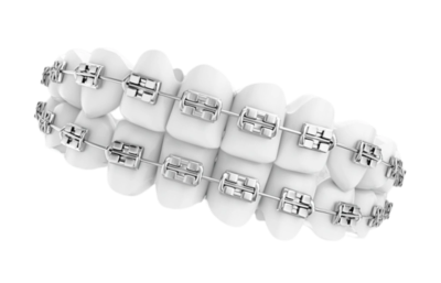 Metal brackets &nbsp;&nbsp;ALA-BS